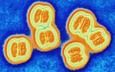 Bacterial meningitis begins as Meningococcal disease, which is a serious illness caused by a type of bacteria called Neisseria meningitidis. It can lead to meningitis (infection of the lining of the brain and spinal cord) and infections of the blood. Leading symptoms include headache, sudden fever and stiff neck.